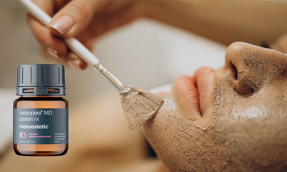 Azelan RX treatment