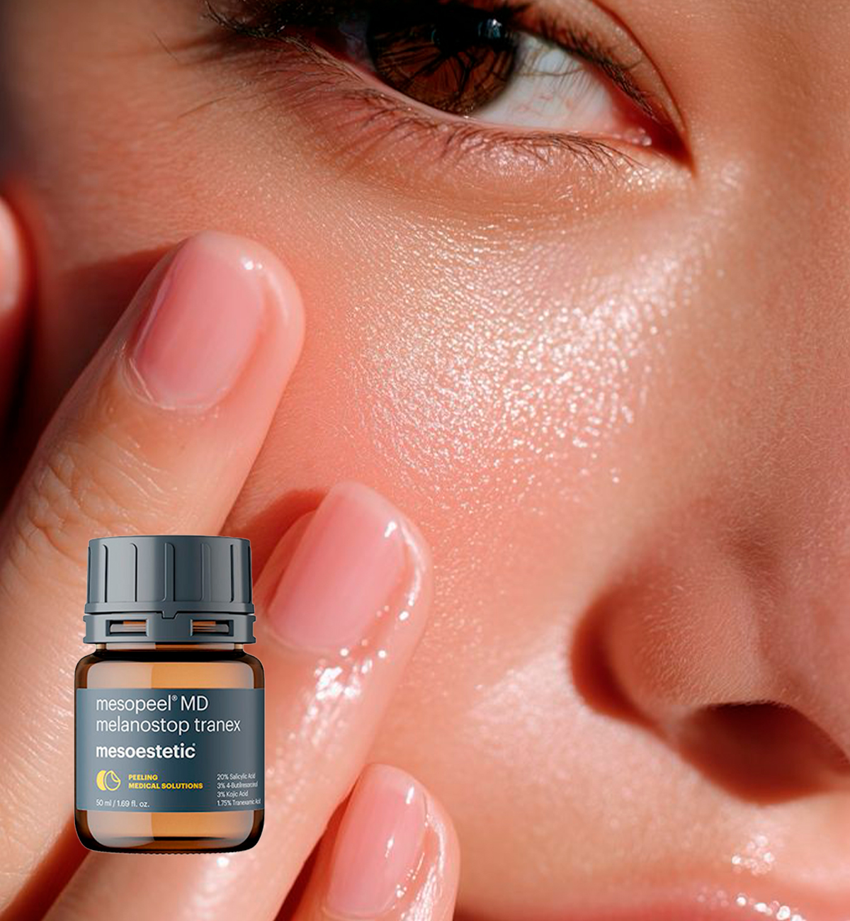 Mesopeel MD Melanostop Tranex treatment at Leyla Skin and Beauty