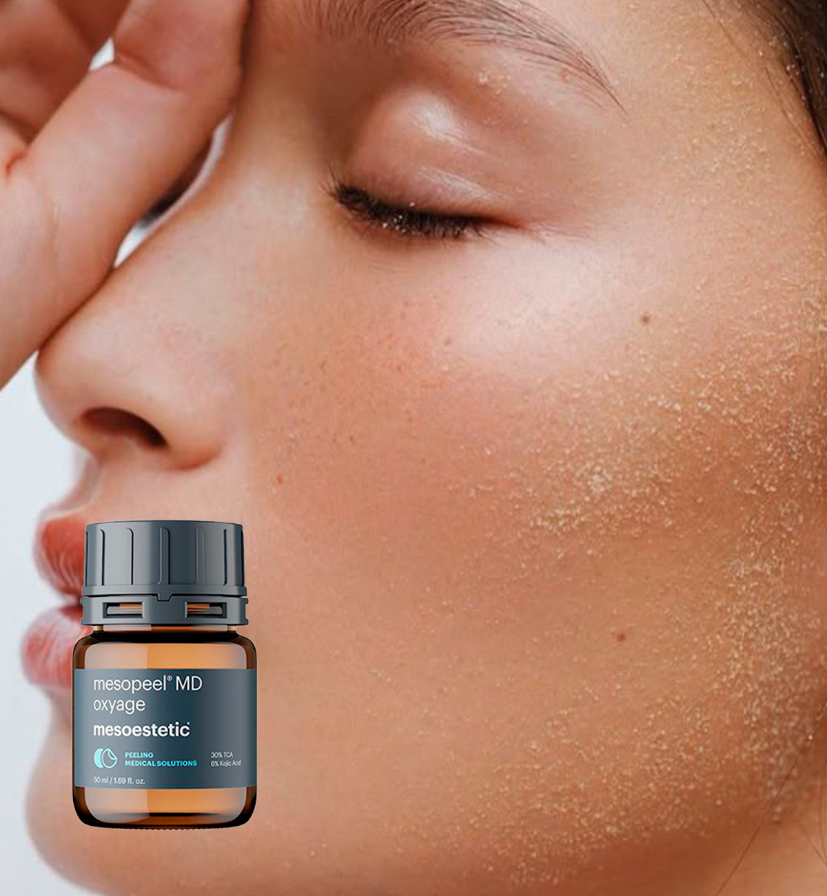 Mesopeel MD Oxyage treatment at Leyla Skin and Beauty