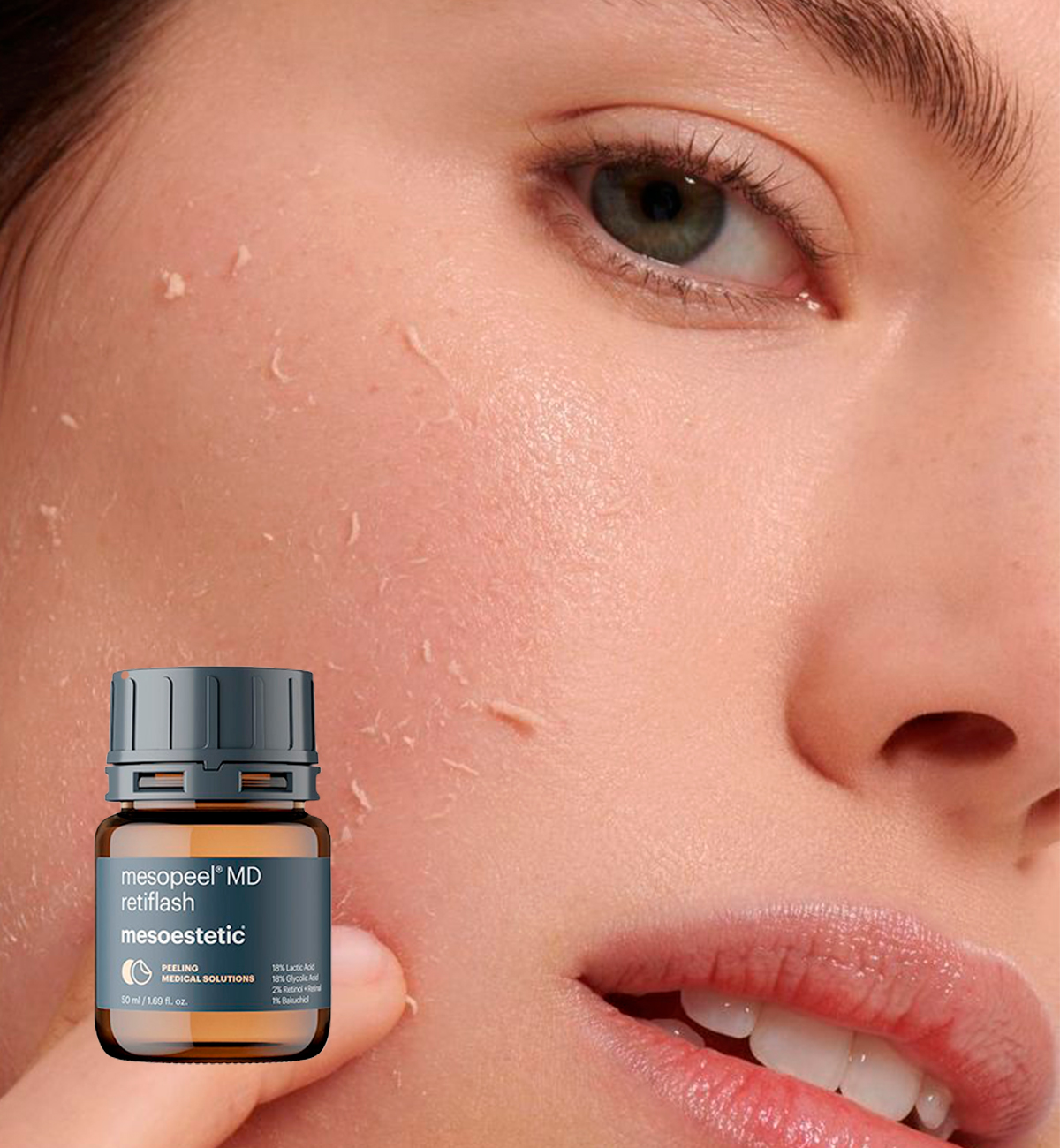 Mesopeel MD Retiflash treatment at Leyla Skin and Beauty